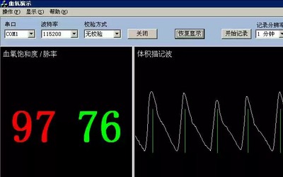 远程患者监测系统血氧饱和度联网